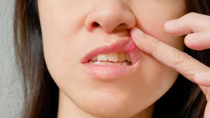 মাড়িতে সমস্যা,ব্যথায় কাতরাচ্ছেন, জটিল রোগ কিনা বুঝবেন কীভাবে?