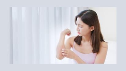 Home Remedies: सर्दियों में सोरायसिस होने का खतरा होता है सबसे ज्यादा, इससे बचने के जानें घरेलू उपाय