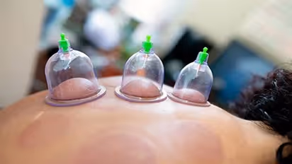 Cupping therapy: शरीर से खून निकालकर खुद को खूबसूरत बनाने सेलेब्रिटी लेते है दर्दनाक थेरेपी, जानिए इसके फायदे