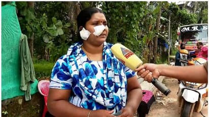 യുവതിയെ ഭര്ത്താവ് മര്ദ്ദിച്ച കേസ്; ജാമ്യത്തിലിറങ്ങി വീണ്ടും ഭീഷണിയെന്ന് യുവതി, കേസെടുത്തു