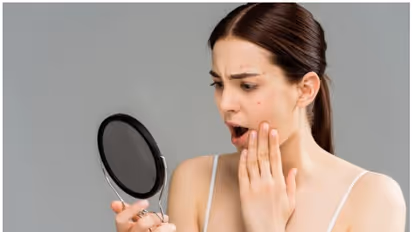 Oily Skin : എണ്ണമയമുള്ള ചർമ്മമുള്ളവർ ശ്രദ്ധിക്കേണ്ട നാല് കാര്യങ്ങൾ