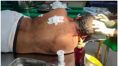 വിവാഹ ഹാളില് മകളെ ശല്ല്യം ചെയ്തു; ചോദ്യം ചെയ്ത അച്ഛനെ യുവാവും സംഘവും കുത്തിപ്പരിക്കേല്പ്പിച്ചു