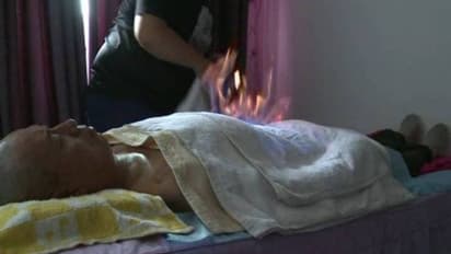 മൊത്തം തീ കൊണ്ടുള്ള കളിയാണ്! ഇവിടെ ശരീരത്തിൽ തീയിട്ടുകൊണ്ടുള്ള ചികിത്സാരീതികൾ