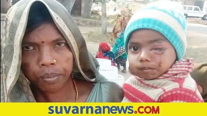 brave mother: ಚಿರತೆಯೊಂದಿಗೆ ಹೋರಾಡಿ ಮಗುವನ್ನು ರಕ್ಷಿಸಿದ ಸಾಹಸಿ ತಾಯಿ