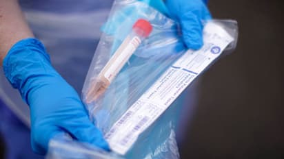 Omicron Variant: ಮೊದಲ ಬಲಿ ಪಡೆದುಕೊಂಡ ಒಮಿಕ್ರೋನ್