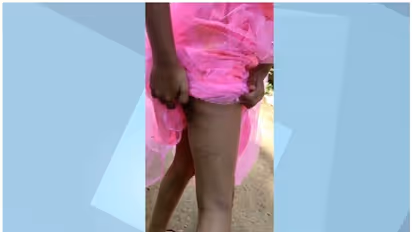 Student : നിലമ്പൂരില് മദ്രസ വിദ്യാര്ത്ഥിനിക്ക് ക്രൂരമര്ദ്ദനം; കാലില് അടിയേറ്റ പാടുകള്, അധ്യാപകനെതിരെ കേസ്