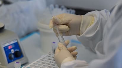 Omicron: ওমিক্রন কতটা বিপদ ডেকে আনছে, স্পষ্ট করে জানালেন মার্কিন রোগ বিশেষজ্ঞ ফাউসি