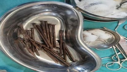 OMG: 17 के लड़के ने रोटी की तरह खा लीं 27 कीलें, डॉक्टर अल्ट्रासाउंड देख हैरान..बोले-ये अभी तक जिंदा कैसे?