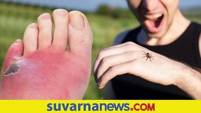 Spider Bites: ರಾತ್ರಿ ಸರಿಯಿದ್ದ ಖಾಸಗಿ ಅಂಗ ಬೆಳಗಾಗೋದ್ರಲ್ಲಿ ದೊಡ್ಡದಾಗಿತ್ತು..!