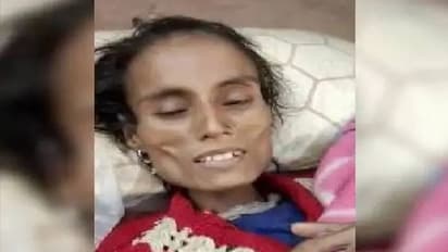 पति बना राक्षस: पत्नी को 4 साल से कमरे में बंद कर रखा था, बन चुकी हड्डियों का ढांचा..पढ़िए शॉकिंग क्राइम