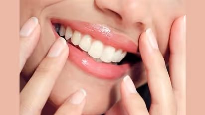 5 foods you should avoid after a teeth whitening session
