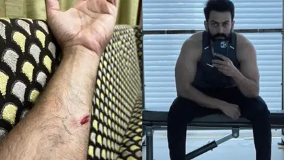 Prithviraj about Kaduva Movie : കൈമുറിഞ്ഞ് പൃഥ്വിരാജ്, 'കടുവ'യിലെ ആക്ഷനെ കുറിച്ച് താരം