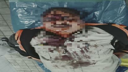 మచిలీపట్నంలో తాగుబోతు వీరంగం... పోలీసులపైనే దాడి, ప్రాణాపాయస్థితిలో కానిస్టేబుల్