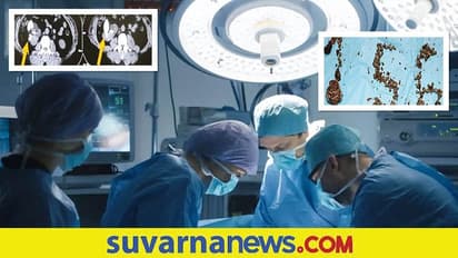 ಇದೆಂತಾ ಅಚ್ಚರಿ.! ವ್ಯಕ್ತಿಯ ದೇಹದಲ್ಲಿದ್ದ Kidney Stone ಕಂಡು ವೈದ್ಯರಿಗೇ ಶಾಕ್!