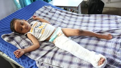 दिव्यांग-गरीबों का सहारा बना नारायण सेवा संस्थान, जीवन में भर रहा खुशियां, सपनों को दे रहा नई उड़ान