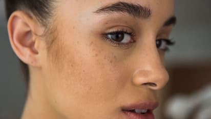 Skin Care : മുഖത്തെ കറുത്ത പാടുകള്‍ മാറ്റാം; വീട്ടില്‍ പരീക്ഷിക്കാം ഇക്കാര്യങ്ങള്‍...