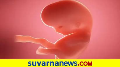 Rare Pregnancy: ಗರ್ಭದಲ್ಲಲ್ಲ, ಮಹಿಳೆಯ ದೇಹದ ಮತ್ಯಾವುದೋ ಭಾಗದಲ್ಲಿ ಭ್ರೂಣ ಪತ್ತೆ..!