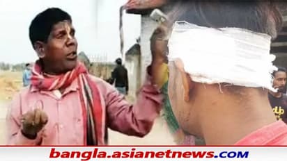 Kacha Badam Song: কাঁচা বাদাম গেয়ে উত্ত্যক্ত করার অভিযোগ,  মাথা ফাটল লিলুয়ার যুবকের