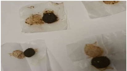 Gulf News : ലഗേജില് കഞ്ചാവുമായെത്തിയ പ്രവാസി വിമാനത്താവളത്തില് പിടിയില്