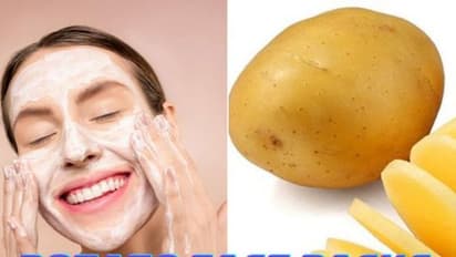 গরম কালে রোদে পোড়া ট্যান দূর করতে চান, রাসায়নিক ছেড়ে কাজে লাগান আলুর ফেসপ্যাক