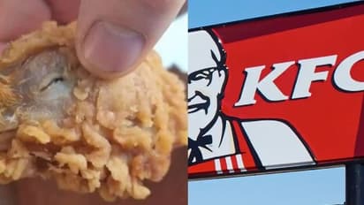 Fried Chicken : ഫ്രൈഡ് ചിക്കന്‍ പാക്കറ്റില്‍ നിന്ന് കോഴിത്തല; പരാതിയുമായി യുവതി