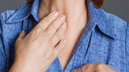 Omicron Less Severe: ಒಮಿಕ್ರೋನ್ ಗಂಟಲಿಗಷ್ಟೇ ಇಳಿಯುತ್ತೆ, ಶ್ವಾಸಕೋಶಕ್ಕಲ್ಲ!