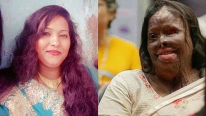 Acid Attack: പ്രേതം പോലുണ്ട്, ആസിഡ് വീണ മുഖം നോക്കി മക്കള്‍ പോലും അവളെ വിളിച്ചു!