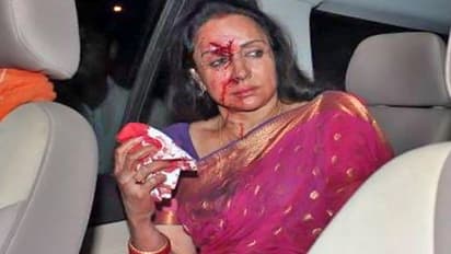 Salman Khan ಮಾತ್ರವಲ್ಲ, ಈ ನಟರೂ ಗಂಭೀರ ಅಪಘಾತಗಳಿಂದ ಬದುಕುಳಿದ್ದಾರೆ!