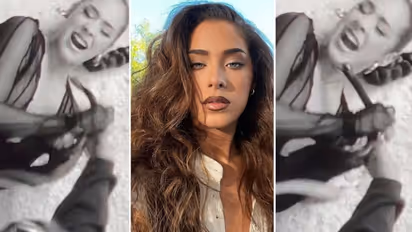 After Salman Khan's snake bite, international singer Maeta bit on the face by a snake (WATCH)