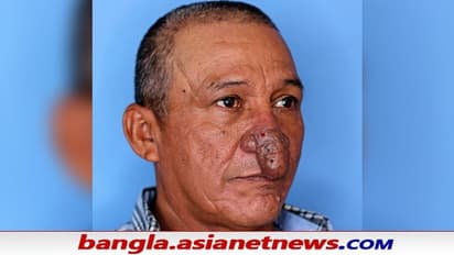 New Nose as Christmas Gift: ক্রিসমাসে 'নাক' উপহার দিল দেবদূত, ভাইরাল কাহিনি