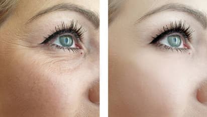 Beauty Tips: ఇలా చేస్తే.. 40 ఏండ్ల వారు కూడా 20 ఏండ్ల వారిలా కనిపిస్తారు..