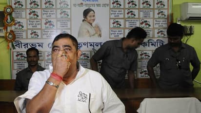 এবার কী করবেন অনুব্রত মণ্ডল? স্বাস্থ্য পরীক্ষা করে তৃণমূল নেতাকে 'খালি হাতে' ফেরাল SSKM