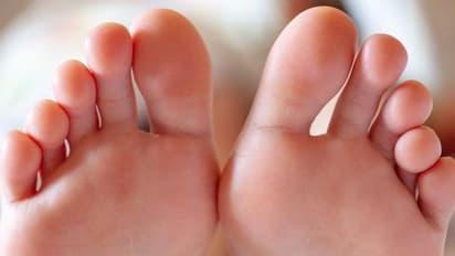 Covid Symptoms : തൊലിയിലും ലക്ഷണങ്ങള്‍ കണ്ടേക്കാം; കൊവിഡ് നേരത്തെ തിരിച്ചറിയാം