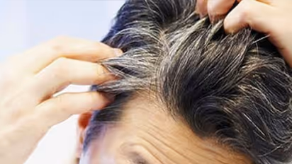 Grey Hair : മുടി നരയ്ക്കുന്നോ? ഭക്ഷണത്തില്‍ ഇക്കാര്യങ്ങള്‍ ശ്രദ്ധിച്ചുനോക്കൂ...