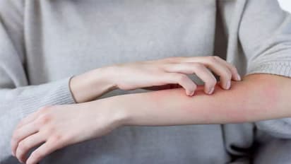 ചർമ്മത്തിൽ ഈ ലക്ഷണങ്ങൾ കണ്ടാൽ നിസാരമായി കാണരുത്, പ്രമേഹത്തിന്റെതാകാമെന്ന് വിദഗ്ധർ