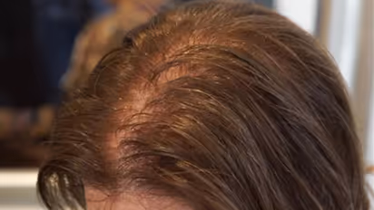 Hair care : ഉള്ള് കുറഞ്ഞ തലമുടിയാണോ പ്രശ്നം? പരീക്ഷിക്കാം ഈ അഞ്ച് കാര്യങ്ങള്‍...