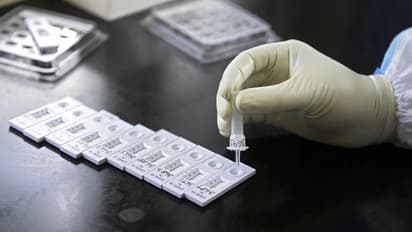 Omicron in Karnataka: ರಾಜ್ಯದಲ್ಲಿ ಮತ್ತೆ 10 ಮಂದಿಗೆ ಒಮಿಕ್ರೋನ್‌: ರೂಪಾಂತರಿ ಕೇಸ್ 76ಕ್ಕೇರಿಕೆ!