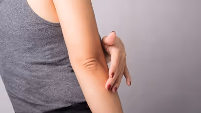 Skin Care : കൈമുട്ടുകളിലെയും കാല്മുട്ടുകളിലെയും കറുപ്പ് നിറം മാറ്റാം...