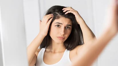 Dandruff: ఇందుకే చుండ్రు ఏర్పడి జుట్టు రాలుతుంది..