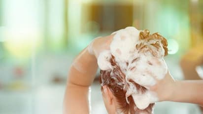 চুলের যত্নে ম্যাজিকের মতো কাজ করবে রসুন, এটি প্যাকের গুণে দূর হবে খুশকির সমস্যা