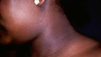 ప్రెగ్నెన్సీ సమయంలో చర్మం నల్లగా ఎందుకు మారుతుందో తెలుసా?