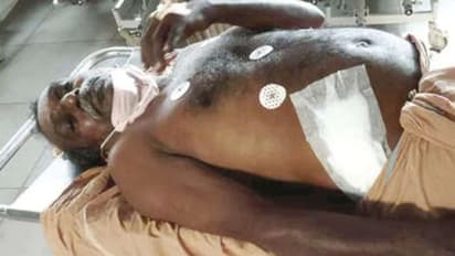 Wild Boar Attack :  കാട്ടുപന്നി ആക്രമണം, കിളിമാനൂരിൽ ഓട്ടോഡ്രൈവ‍ർക്ക് ​ഗുരുതര പരിക്ക്