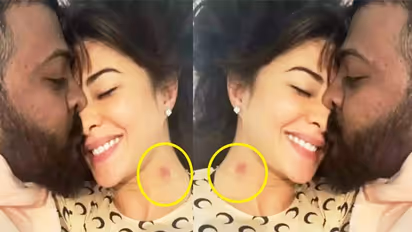 Jacqueline Fernandes ही नहीं इन 11 सेलेब्स के बदन पर भी मिले Love Bite के निशान, सैफ और बेटी सारा भी शामिल