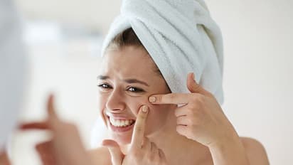 Acne Solution : മുഖക്കുരുവിന് മണിക്കൂറുകള്ക്കുള്ളില് പരിഹാരം? അറിയാം ചില ടിപ്സ്...