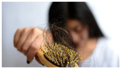 Hair loss : മുടികൊഴിച്ചിൽ അലട്ടുന്നുണ്ടോ? എങ്കിൽ കാരണങ്ങൾ ഇതാകാം
