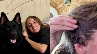 पालतू कुत्ते ने मालिक की गर्लफ्रेंड के साथ की ऐसी हैवानियत, काटकर फेंका शरीर का ये टुकड़ा