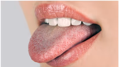 నాలుక తెల్లగా ఉంటే ఎన్నో రోగాలొస్తయ్.. అందుకే ఇలా చేయండి?