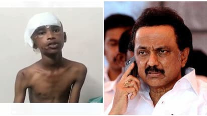 திமுக அரசின் திட்டம்-உயிர் பிழைத்த சிறுவன் முதல்வரிடம் பேச ஏக்கம்.. சர்ப்ரைஸ் தந்த ஸ்டாலின்.! உள்ளே வீடியோ..