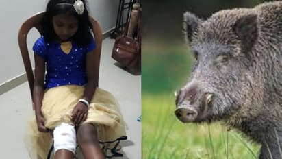 കാട്ടുപന്നി കുറുകെ ചാടി: സ്കൂട്ടറില്‍ നിന്നും വീണ് ഒൻപത് വയസ്സുകാരിക്ക്  പരിക്കേറ്റു