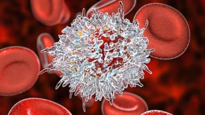 Blood Cancer :  രക്താർബുദ സാധ്യത കുറയ്ക്കാൻ പരിമിതപ്പെടുത്തേണ്ട അഞ്ച് ഭക്ഷണങ്ങൾ
